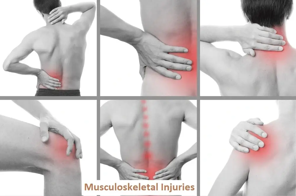 musculoskeletal-injuries